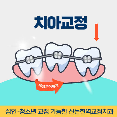 창원치과 창원시 치과 치아교정