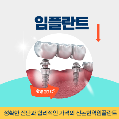 창원치과 창원시 치과 임플란트