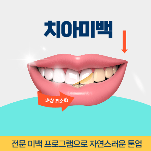 창원치과 창원시 치과 치아미백
