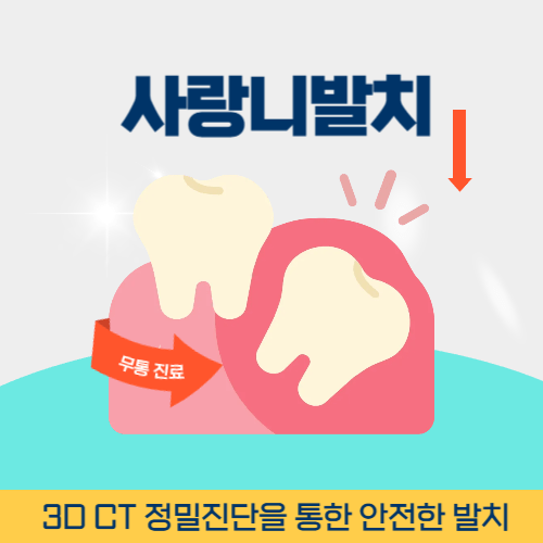 창원치과 창원시 치과 사랑니 발치