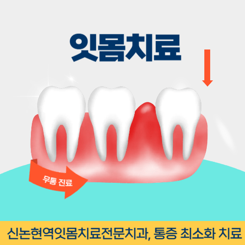 창원치과 창원시 치과 잇몸치료